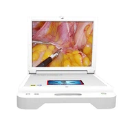 病院用ポータブル耳鼻咽喉科内視鏡カメラ