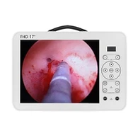 ポータブル腹腔鏡検査フル HD 内視鏡検査装置